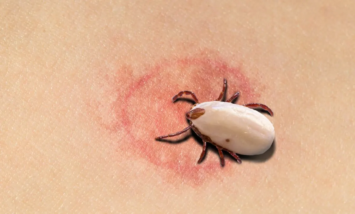 ticks and lyme disease in Pennsylvania