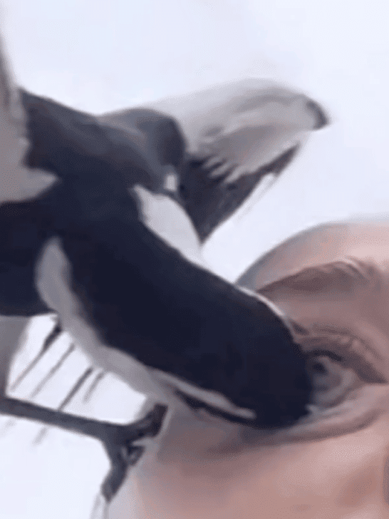 Magpie Attacks Woman And Pecks Her Eye
