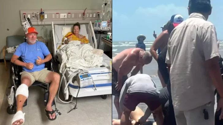 Woman Loses Calf in Devastating Shark Attack After Mistaking It for a Large Fish