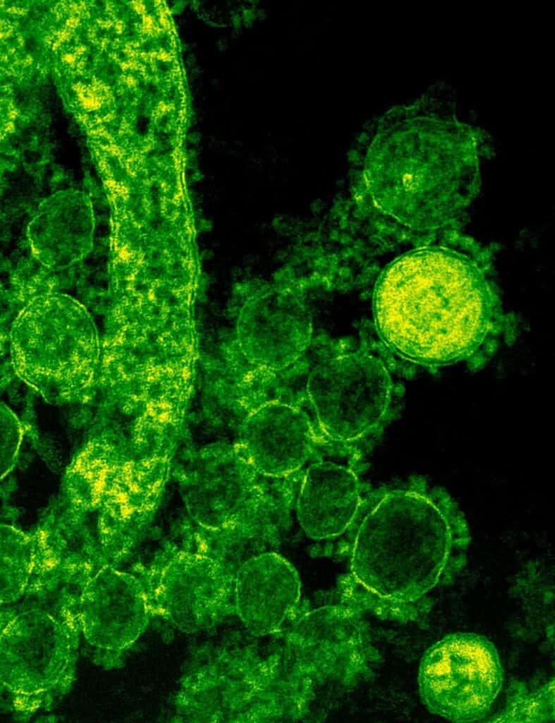 virus