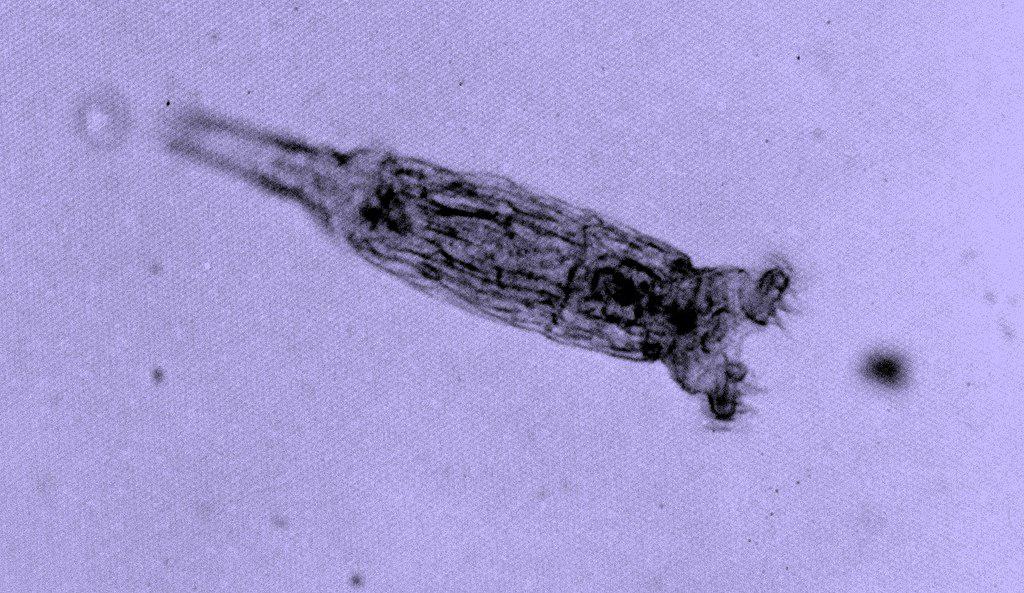 Bdelloid Rotifers