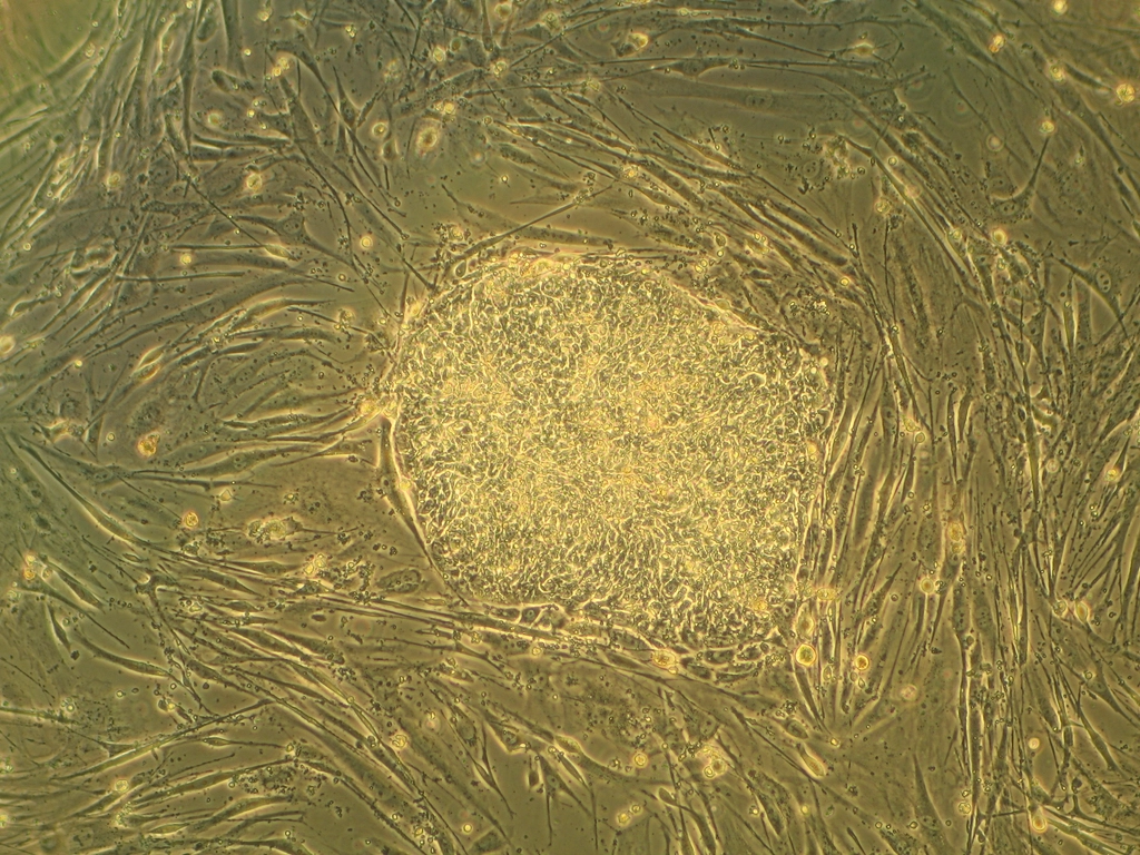 The Role of Stem Cells
