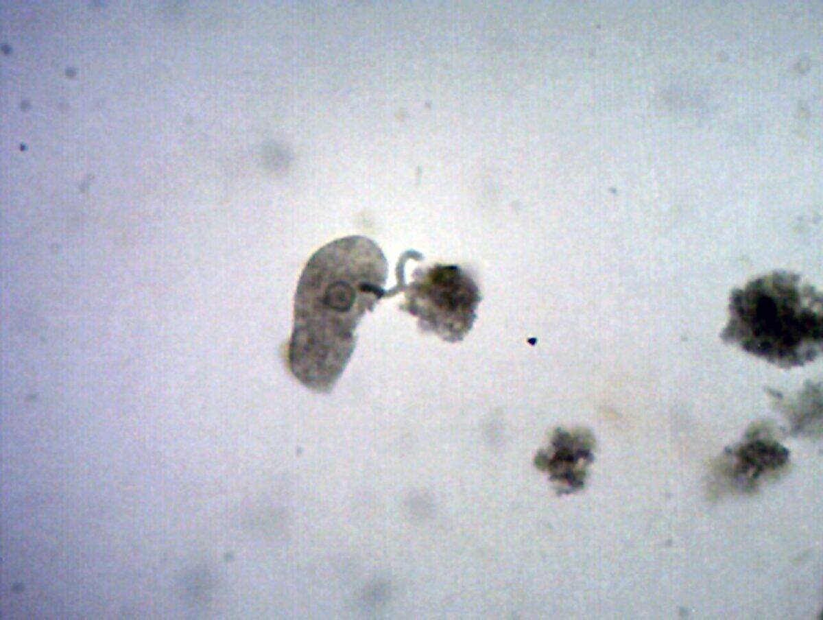 Anaerobic