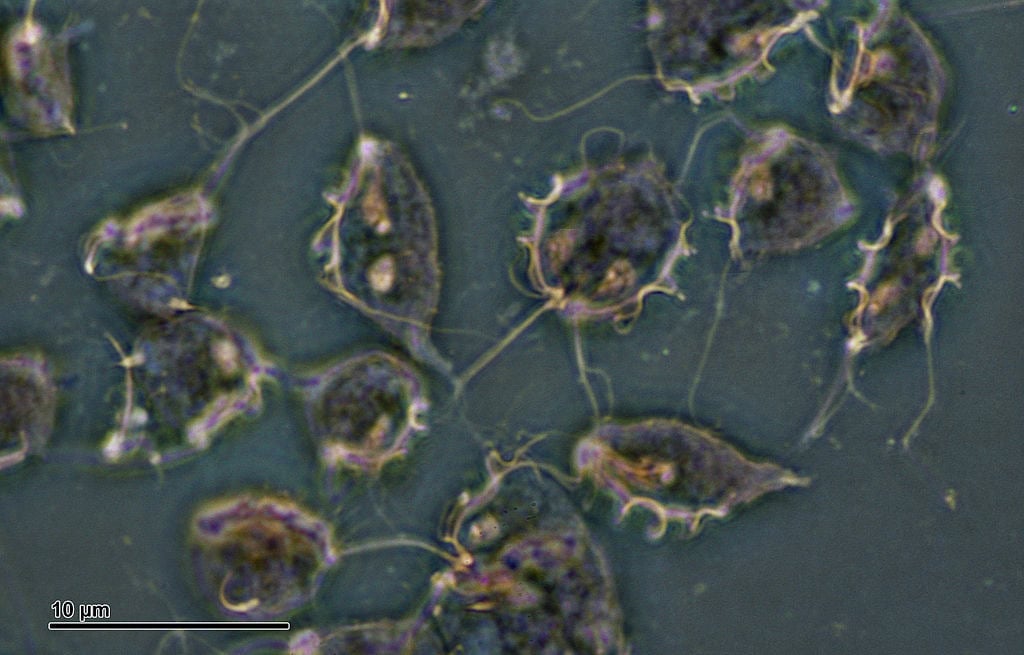 Trichomonas (251 29) Cultured