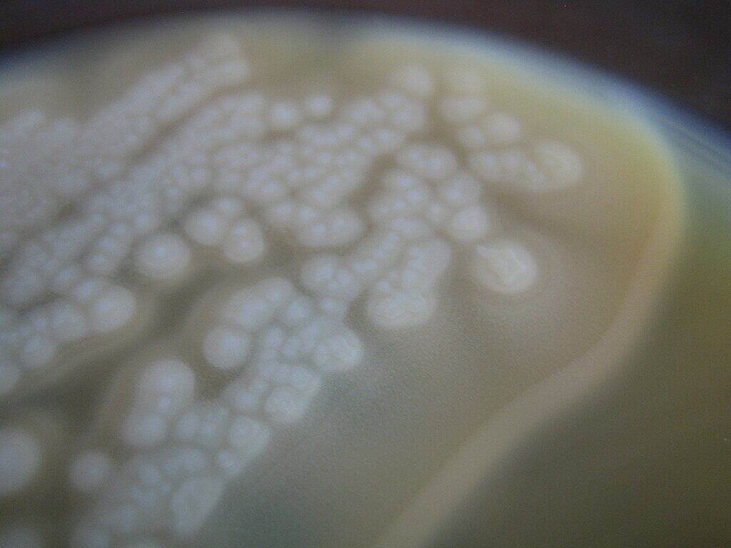 Clostridium botulinum