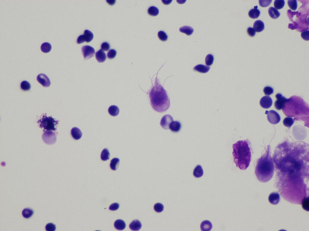 Giardia lamblia seen in a cytologic preparation (cytospin of formalin from small bowel biopsy of a patient with giardia).