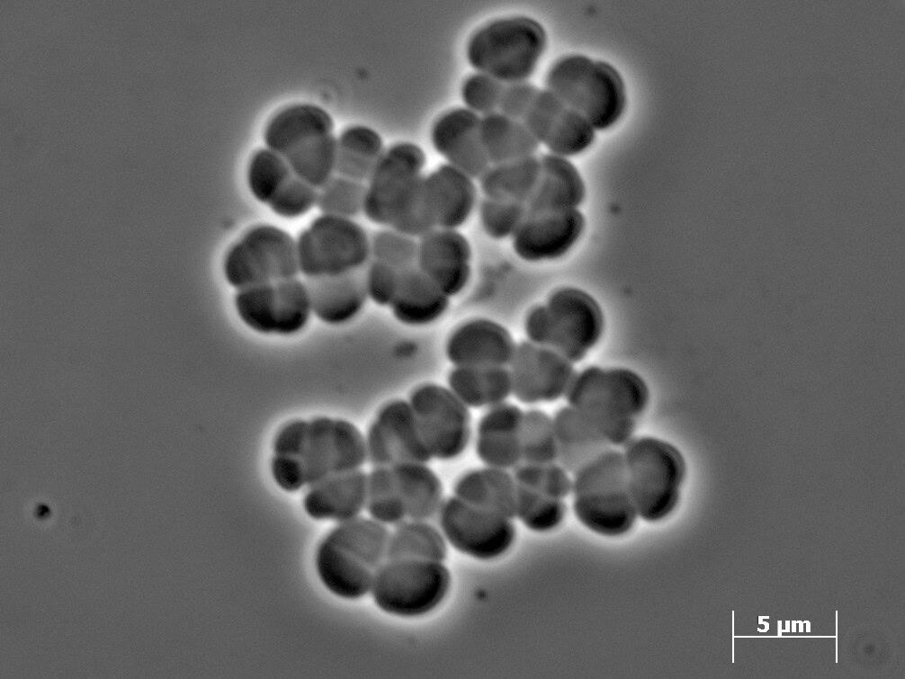 Methanogen
