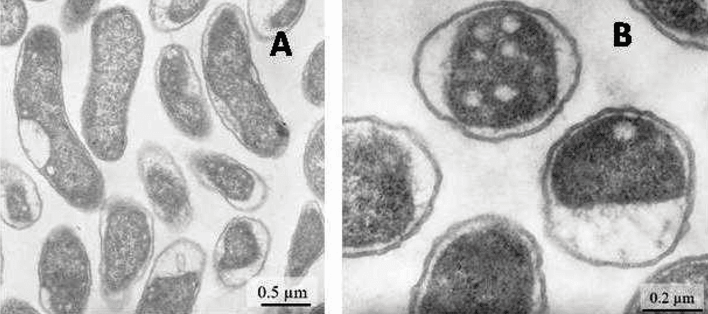 Desulfovibrio vulgari