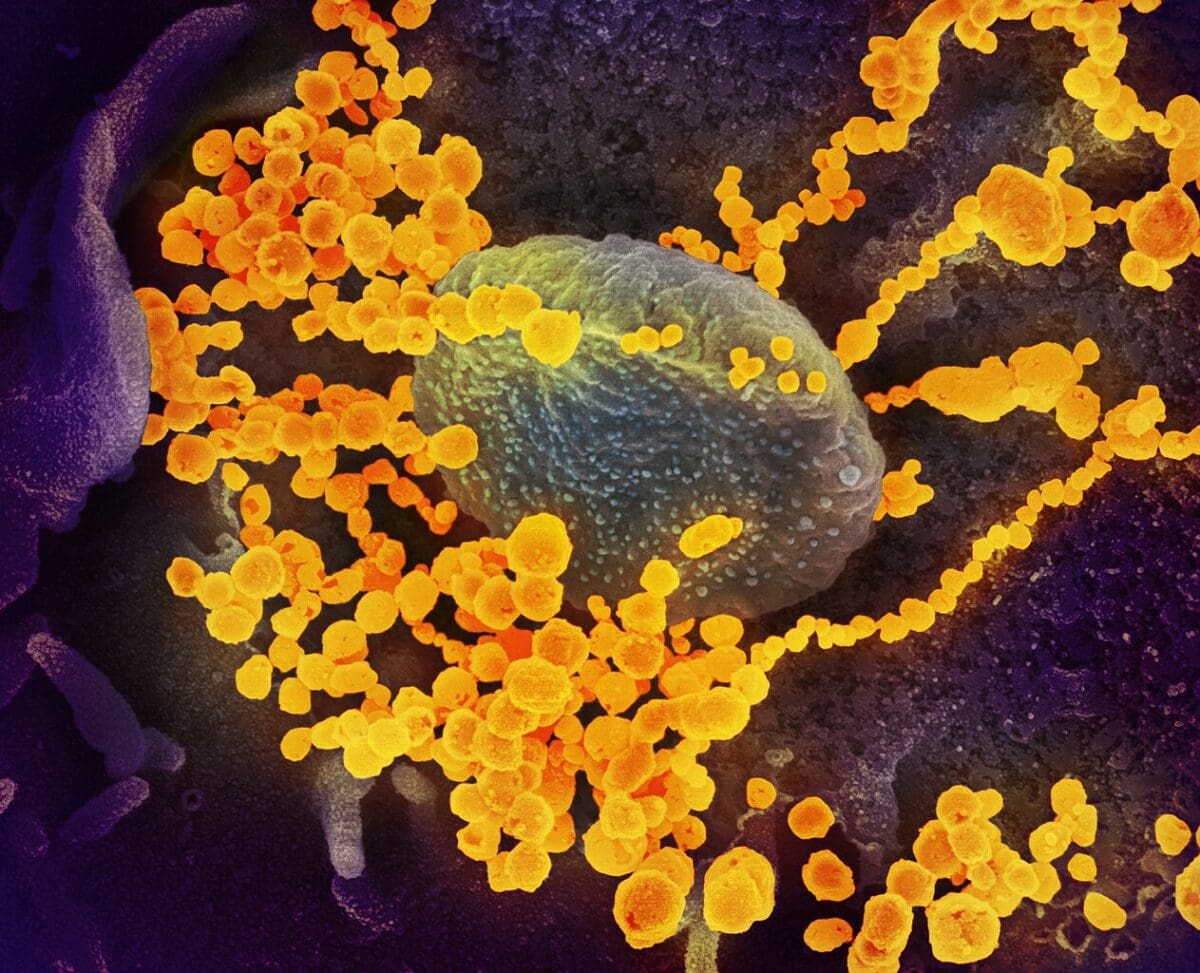 scanning electron microscope image
