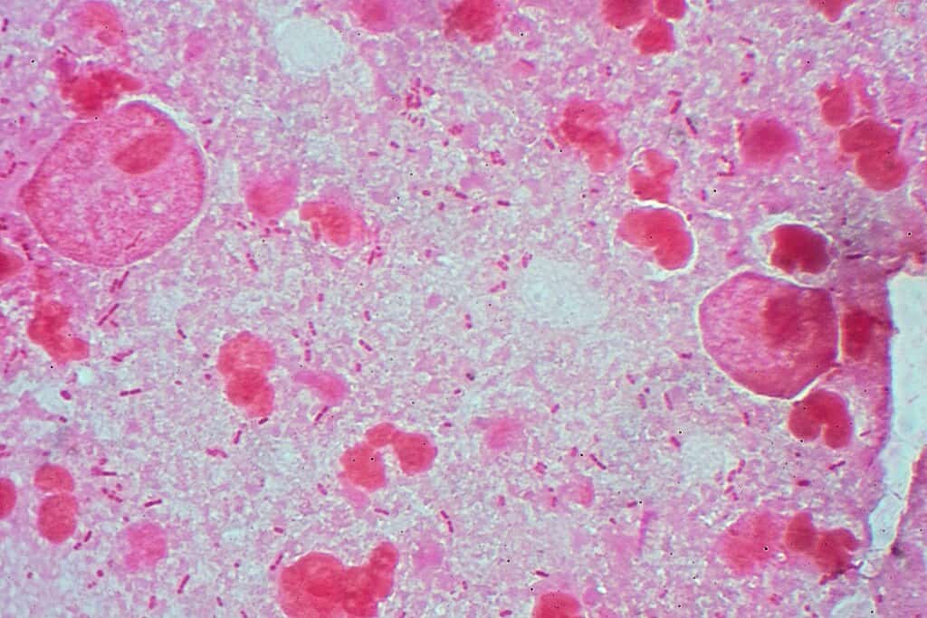 Trichomonas Gram stain