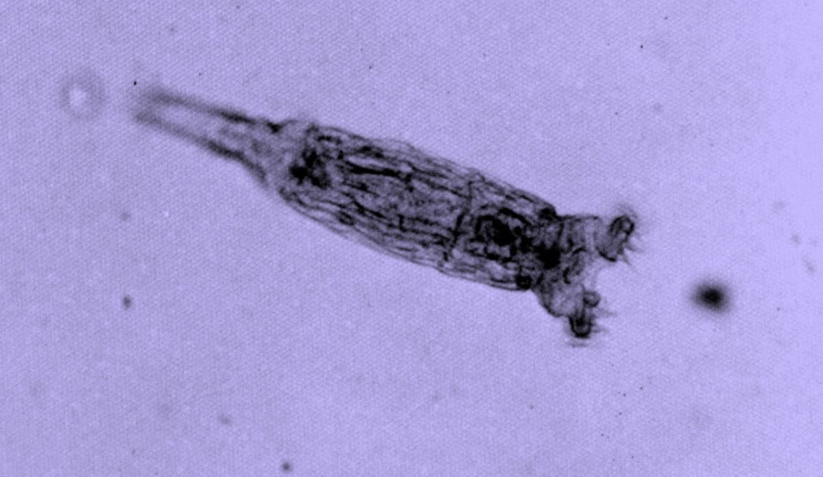 bdelloid rotifer