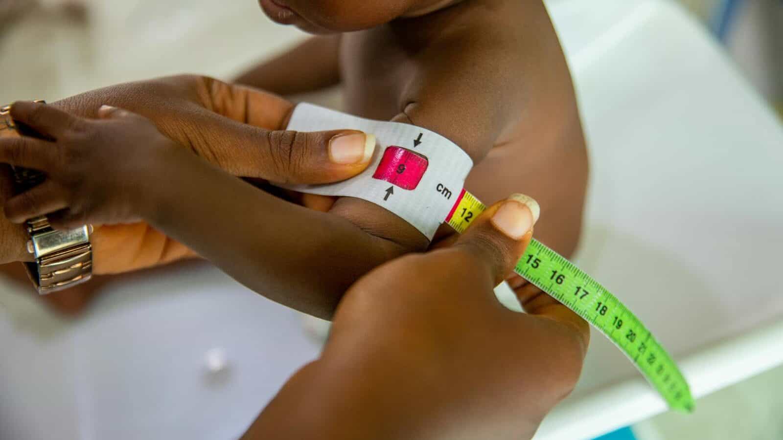 A healthcare professional measures a child's arm using MUAC tape for malnutrition assessment.