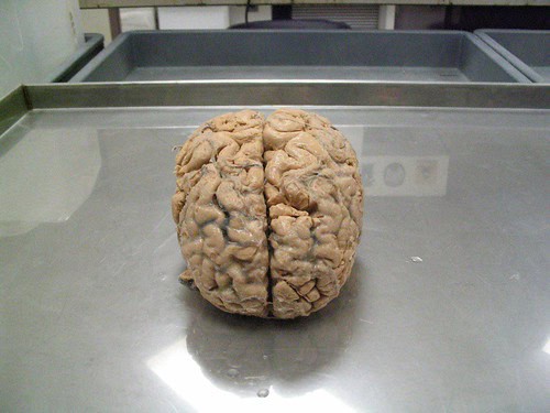 Human brain