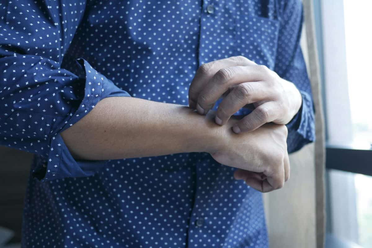 A man scratching his skin.