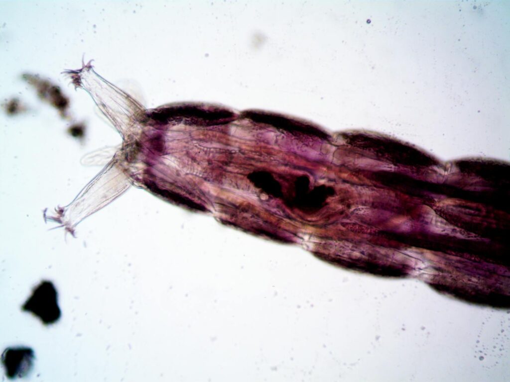 Detailed view of a rotifer, showcasing its intricate structure and features.