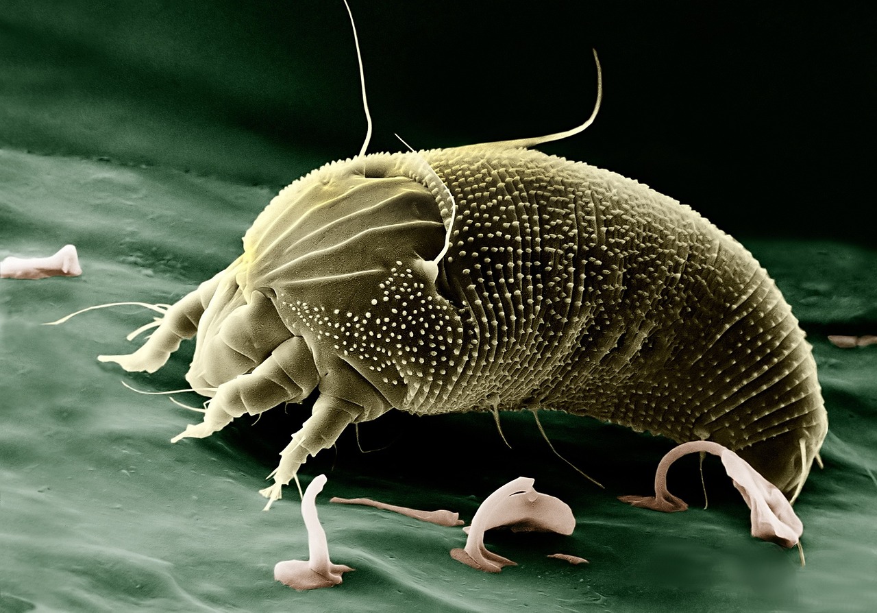 The Invulnerable: Tardigrades (image credits: pixabay)