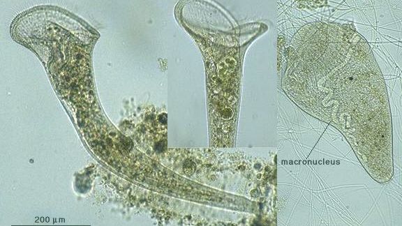 New Study Shows How Single-Celled Stentor Coeruleus Can Actually Learn